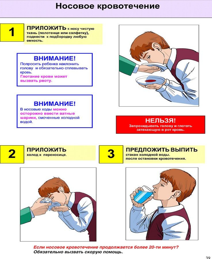 Первая помощь при носовом кровотечении