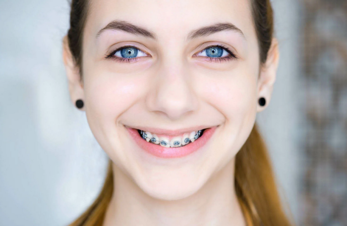 Размерът на зъбите засяга характера
