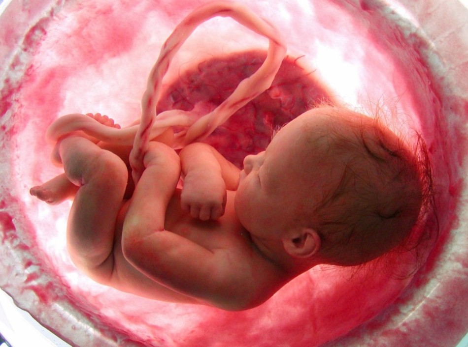 Отварянето на пъпната връв е едно от противопоказанията за раждането на лотоса