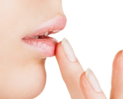 Устната се напука в средата и не лекува при възрастен и дете: причините, лечението - мехлеми и народни средства, знаци
