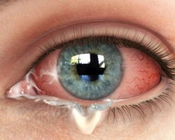 Separaciones del ojo del blanco: las causas de espumas, secreciones filamentosas en adultos y niños, drogas, gotas, métodos populares