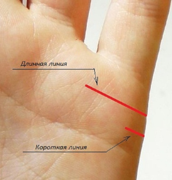 Пример длинной и короткой линии привязанностей на доминантной руке