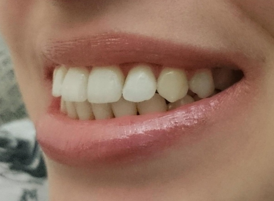 Los fisonomistas describen a las personas con dientes sobresalientes como la naturaleza de las extraordinarias