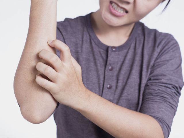 Μαύρες, κόκκινες, λευκές κηλίδες στους αγκώνες σε ενήλικες και παιδιά: αιτίες, μέθοδοι θεραπείας με λαϊκές μεθόδους και φαρμακείο, κριτικές