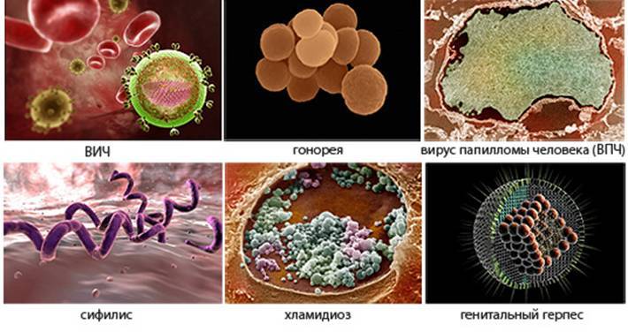 Вирусы и бактерии возбудители ЗППП