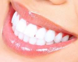 5 лучших способов отбелить зубы естественным путем в домашних условиях: советы экспертов