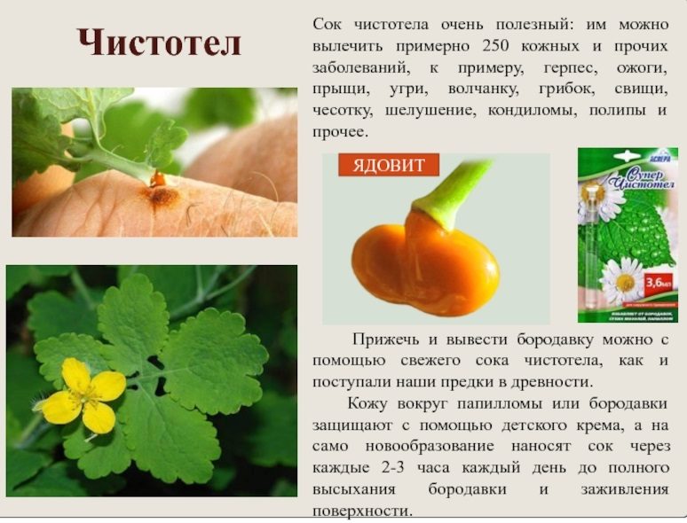 Как правильно прижечь бородавку чистотелом