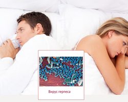 Герпес на губах и в носу: симптомы, причины, лечение. Опасен ли герпес, как происходит заражение герпесом?