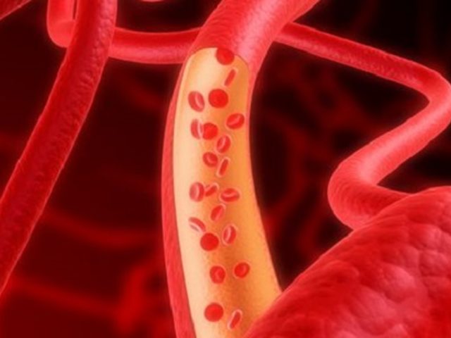 Как почистить сосуды? 5 лучших рецептов очищения сосудов головного мозга. Лекарственные средства и препараты