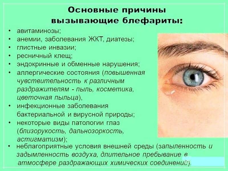 Причины блефарита