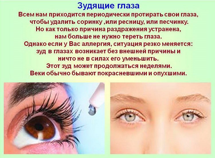 Зуд в глазах может быть при аллергии