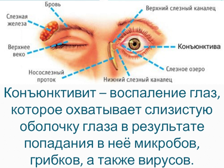 Причины конъюнктивита