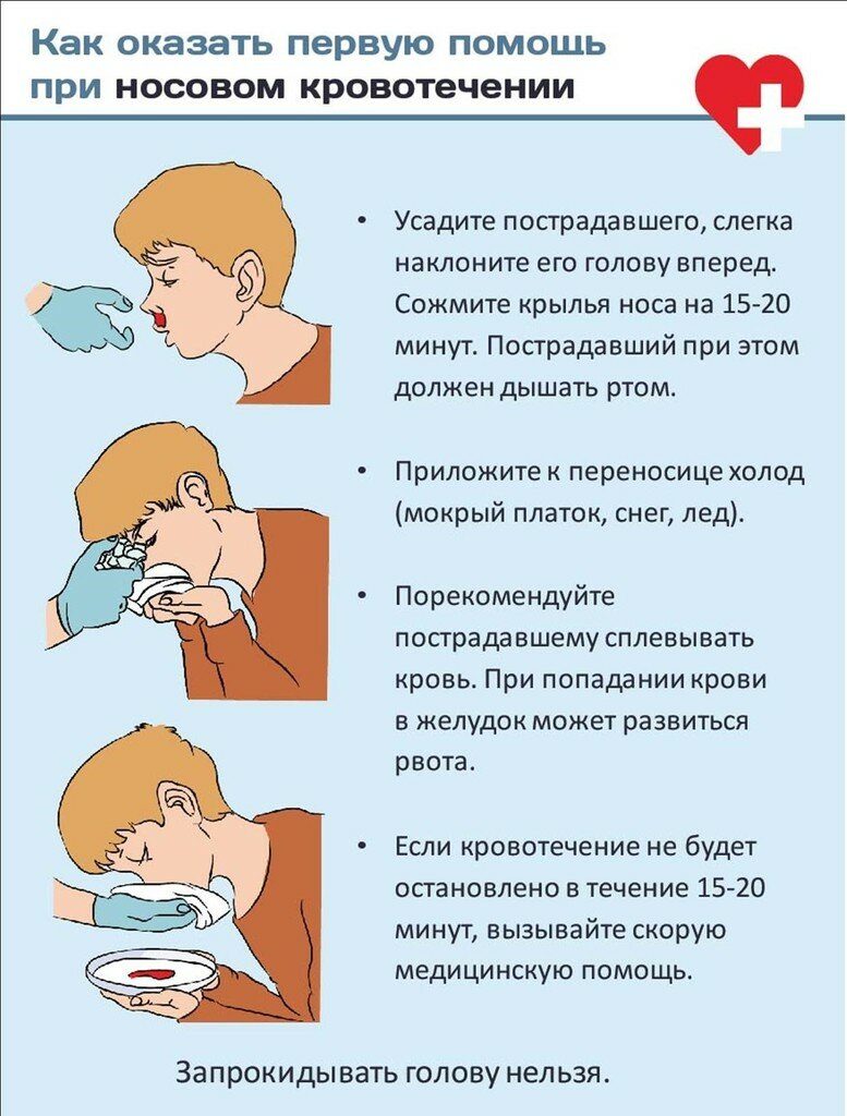 Первая помощь, если пошла кровь из носа