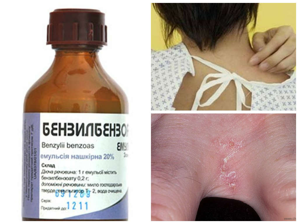 Бензи
