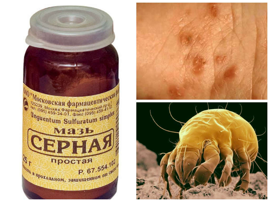Серная мазь