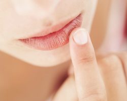 Эксфолиативный хейлит губ: причины, симптомы, лечение
