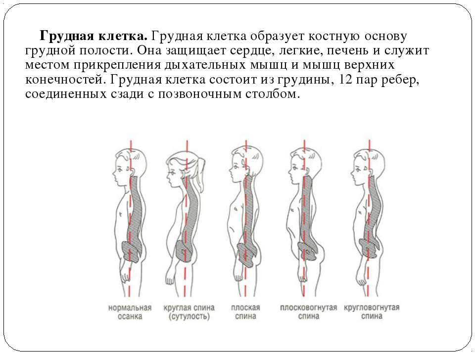Диагностика неправильной осанки