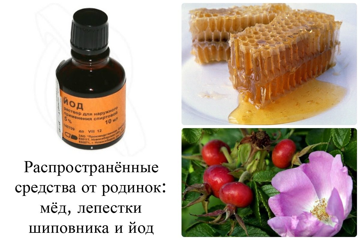 Лечение-родинок