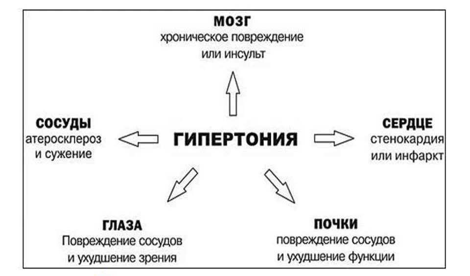 Последствия гипертонии могут быть очень тяжелыми