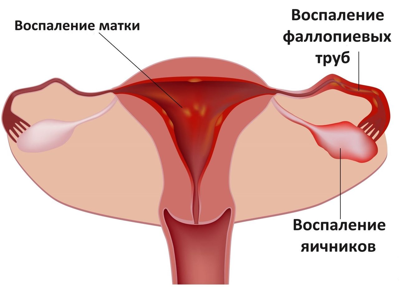 Причины боли слева у женщины