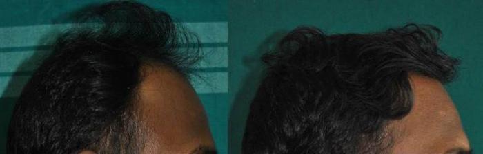 Hair megaspray для мужчин