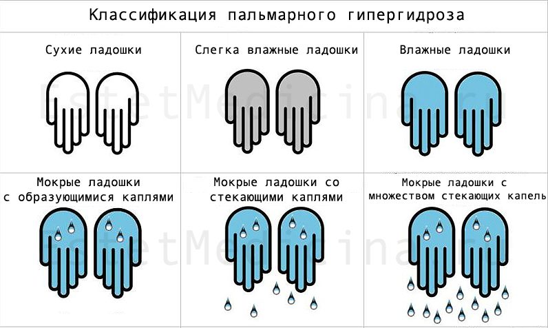 Что такое гипергидроз ладоней и стоп