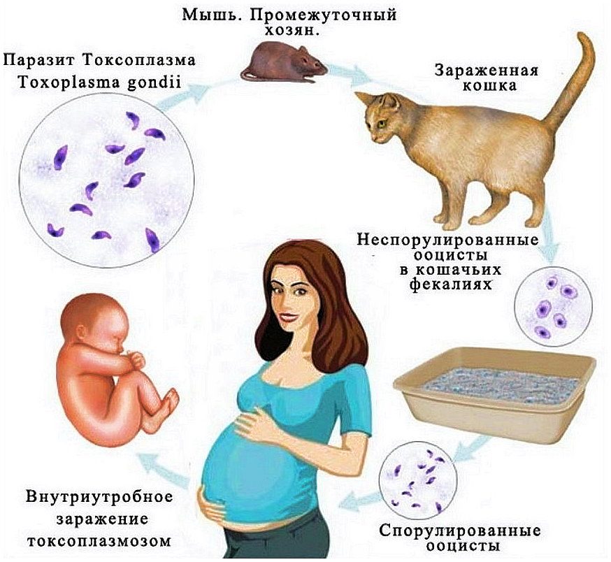 Как можно заразиться токсоплазмозом?