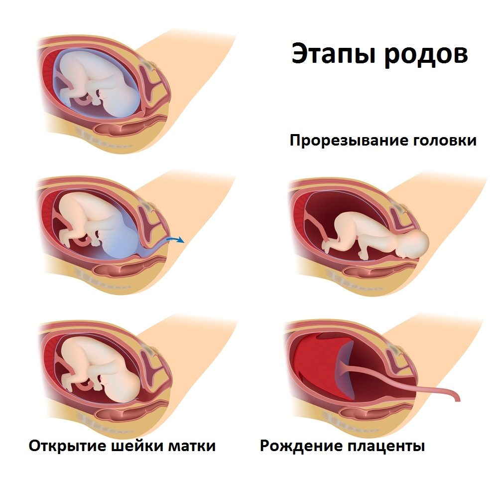 Этапы родов