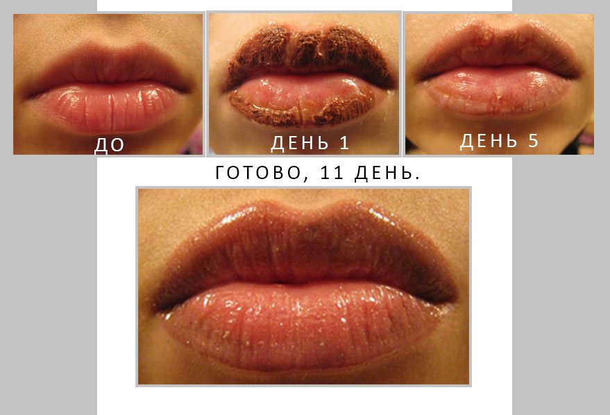 Заживление губ после татуажа