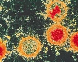 Вирус Эпштейна Барр у взрослых и детей: симптоматика, диагностика и лечение. Чем опасен мононуклеоз для взрослых, детей и при беременности?