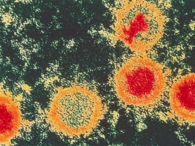 Вирус Эпштейна Барр у взрослых и детей: симптоматика, диагностика и лечение. Чем опасен мононуклеоз для взрослых, детей и при беременности?