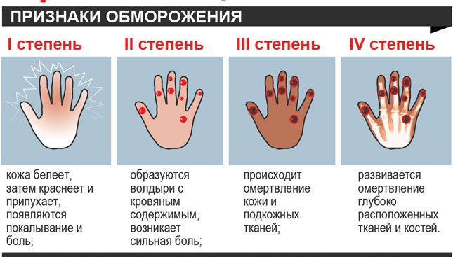 Признаки обморожения.