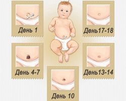 У новорожденного кровит пупок: что делать? Как правильно обрабатывать пупок у новорожденного? Почему мокнет и кровит пупок у новорожденных?