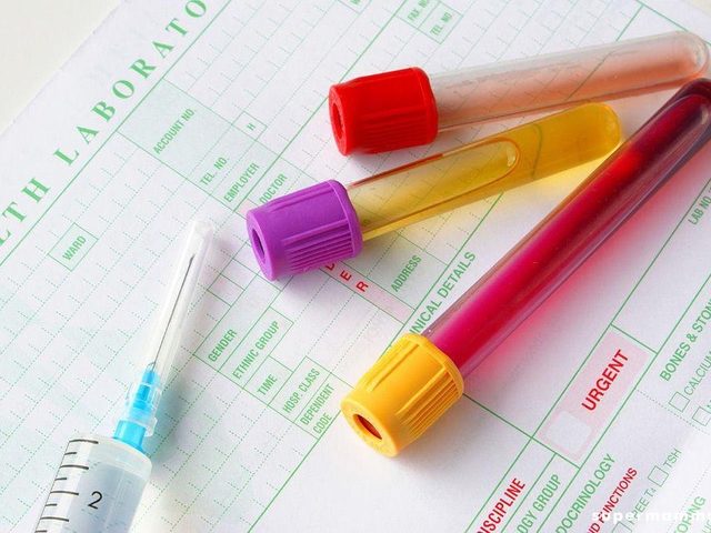 Что такое ХГЧ? Когда делать анализ крови, тест на ХГЧ?