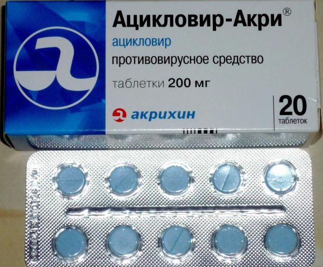 Ацикловир в таблетках - эффективный препарат от герпеса.