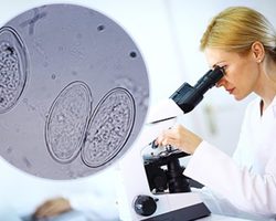 Что такое анализ на энтеробиоз и сколько дней делается? Анализ на энтеробиоз: как берут соскоб у взрослых и детей — алгоритм