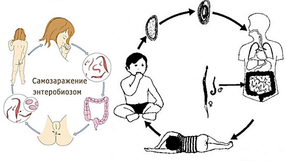 Перенося яйца остриц с пеанальных складок ко рту, человек сам себя заражает энтеробиозом.