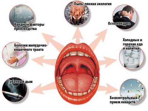 Симптомы и признаки тонзиллита