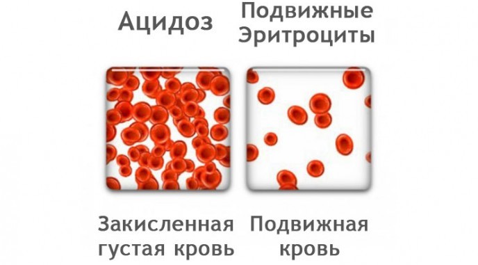Какие анализы сдать на закисление, ощелачивание организма?