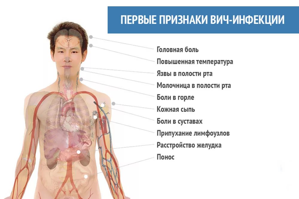 Первые признаки вич