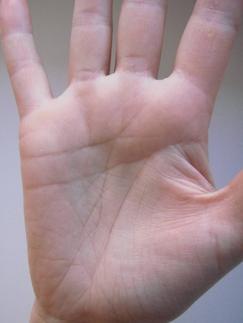 Пересечение линии сердца с линией судьбы указывает на неудачный брак