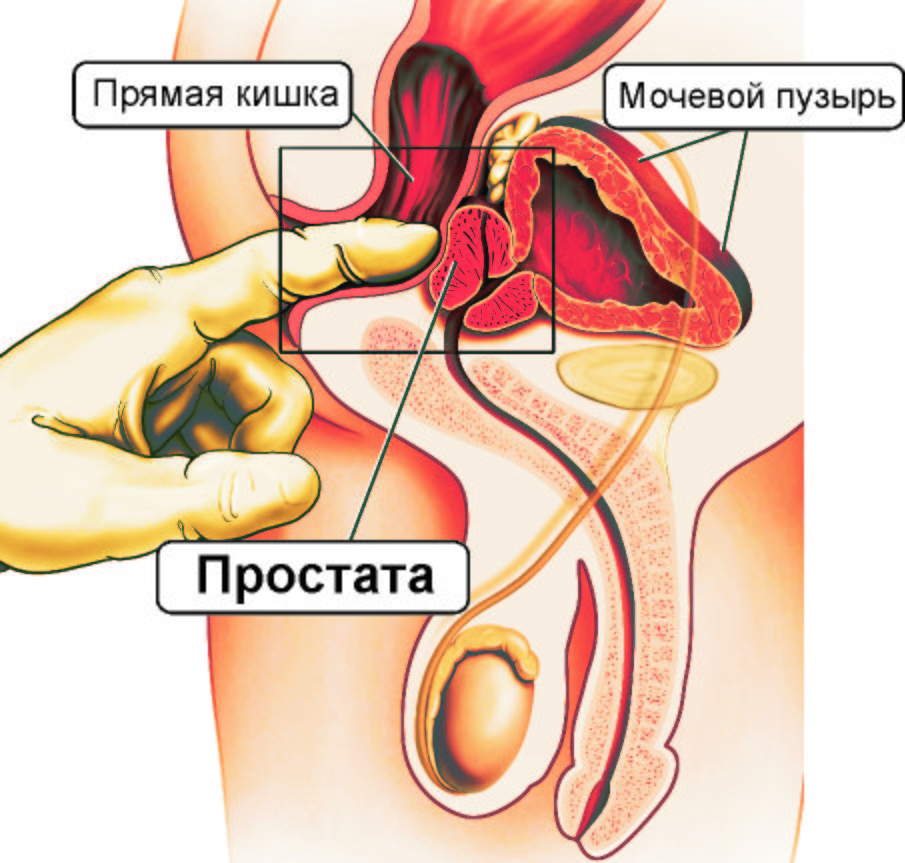 Как делать массаж простаты пальцем для кайфа мужчине, мужу: техника прямого массажа