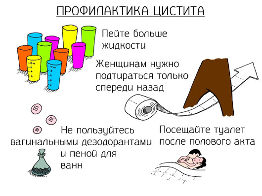 Профилактика цистита: комплекс мер