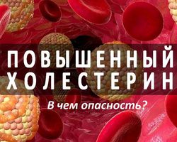 Как быстро понизить холестерин в крови у мужчин и женщин в домашних условиях: препараты, диета и продукты, травы, народные средства, снижающие холестерин и очищающие сосуды — список. Как купить прибор для измерения холестерина в крови и тест полоски на Алиэкспресс?
