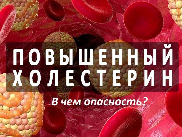 Как быстро понизить холестерин в крови у мужчин и женщин в домашних условиях: препараты, диета и продукты, травы, народные средства, снижающие холестерин и очищающие сосуды — список. Как купить прибор для измерения холестерина в крови и тест полоски на Алиэкспресс?