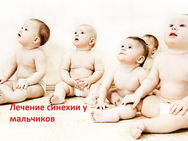 Как выглядят синехии крайней плоти у мальчиков, и как должно быть: фото. Лечение синехии и уход после разделения синехий у мальчиков: лекарственные средства, советы и отзывы
