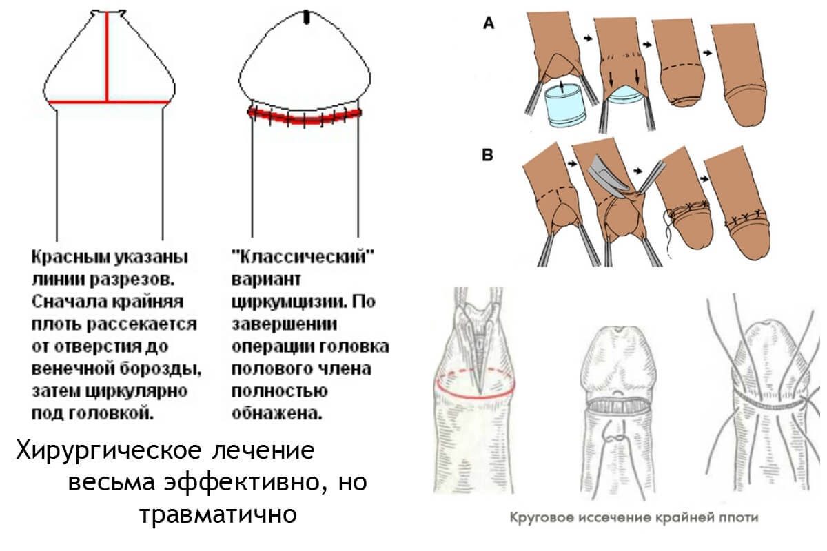 Хирургическое лечение
