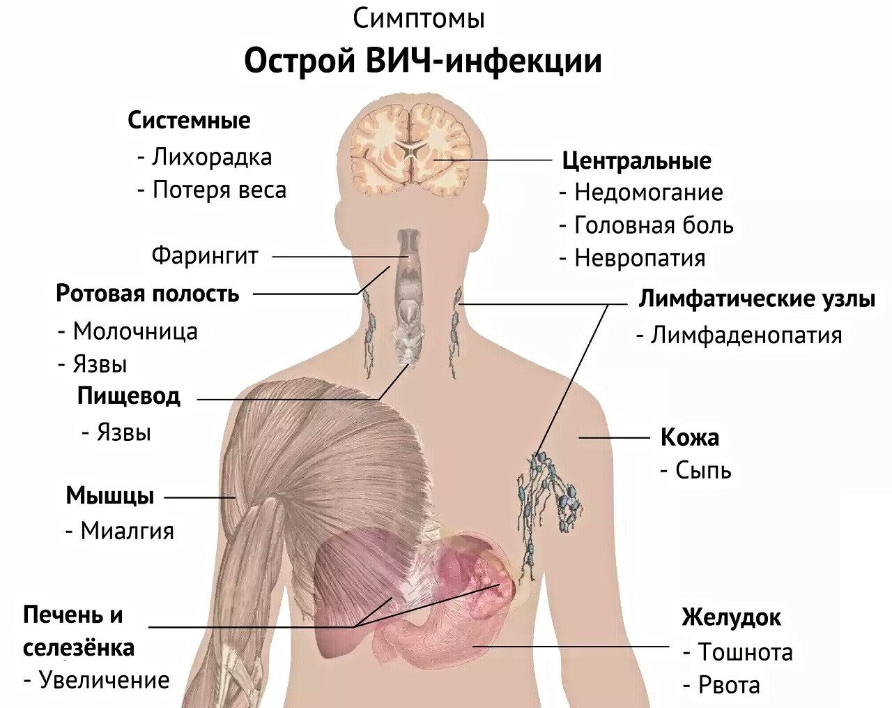 Как определить, что вич инфекция переходит в спид: симптомы, последствия