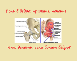 Боль в ноге от бедра и в паху: причины, лечение, какой врач лечит. Почему болит правое и левое бедро сбоку, при ходьбе, до колена и стопы?