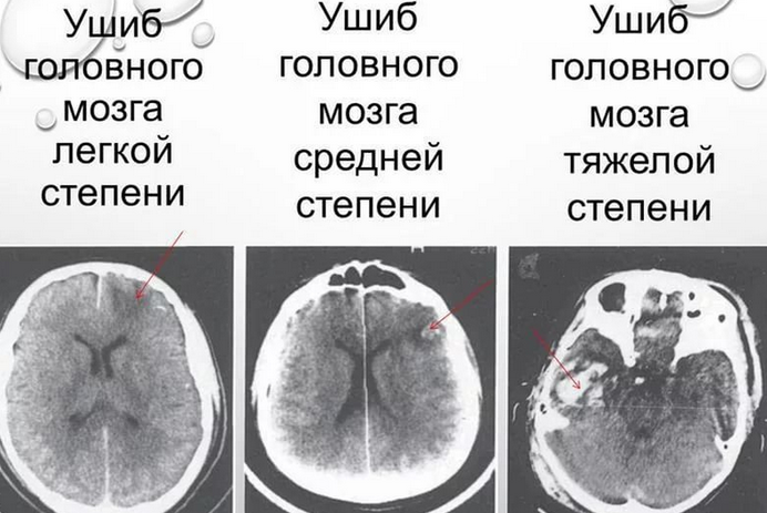 Несколько степеней